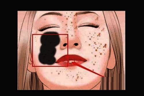 修复前后对比图，突出修复后皮肤变得光滑的效果