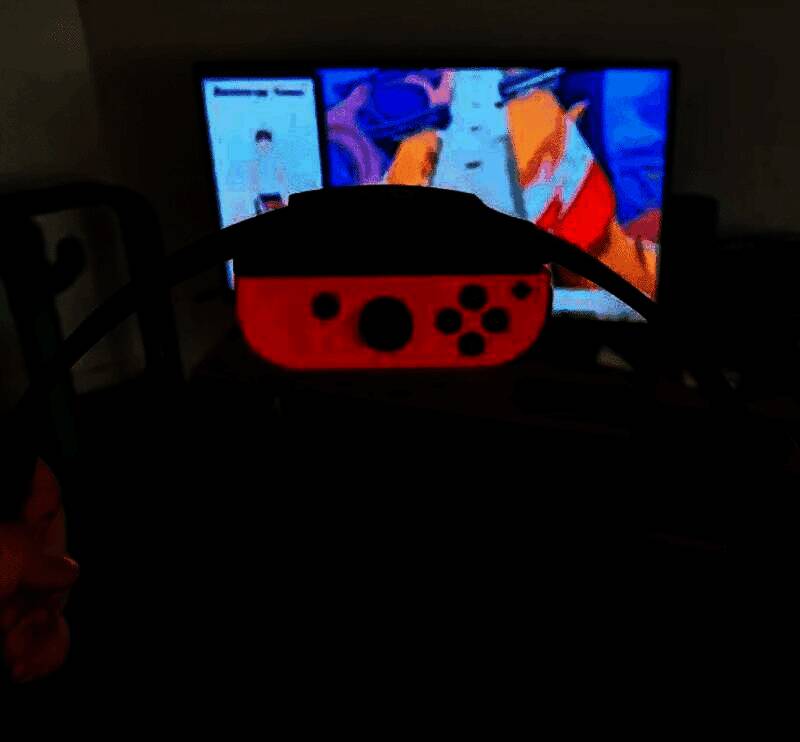 医学示意图展示颈部动脉撕裂及血栓形成过程，标注出血液渗入血管壁并阻塞脑部供血路径的细节