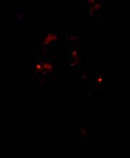 《血色杀戮》 v1.0.6升级档+未加密补丁[SKIDROW]