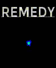 《Remedy》英文免安装版