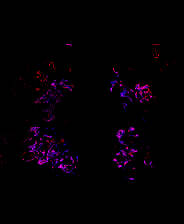 《片段》简体中文免安装版